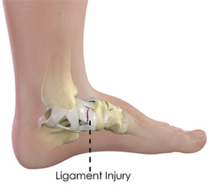 Ankle Ligament