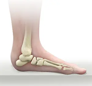 Pediatric Foot Conditions images