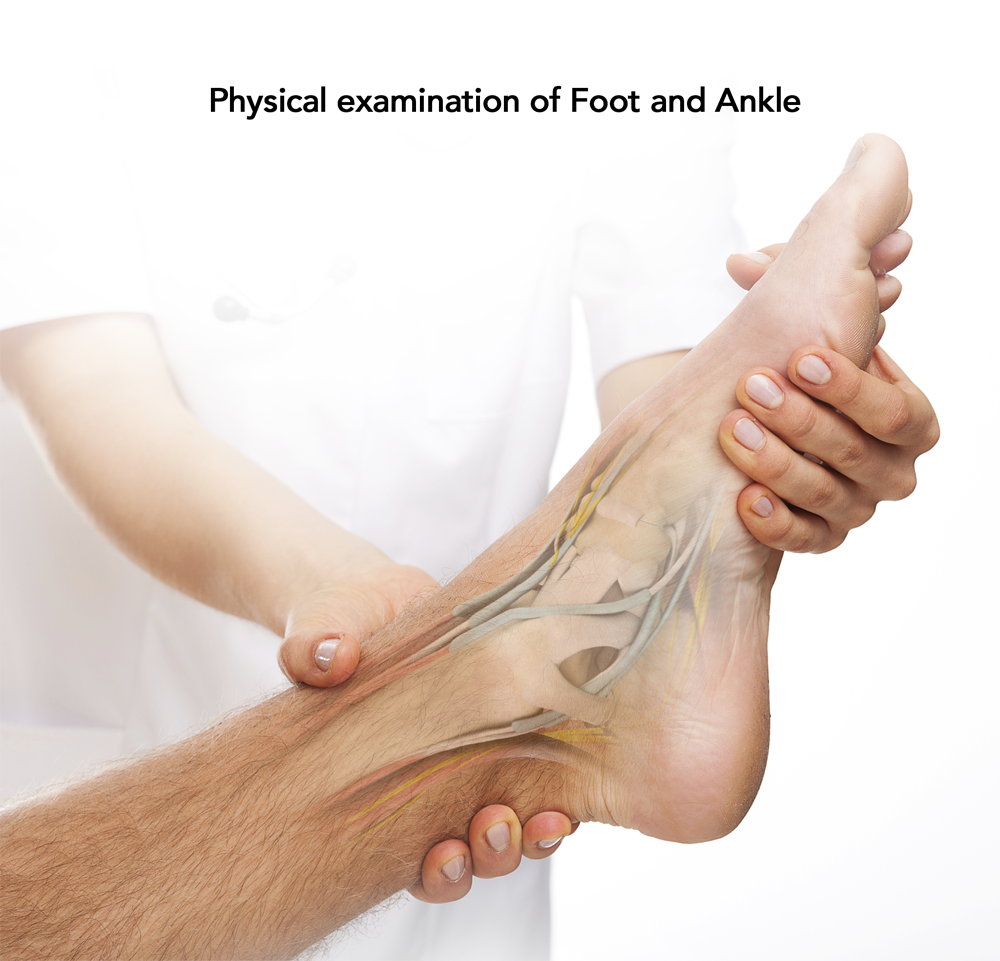 Foot Examination Bristol, TN Ankle Surgery Abingdon, VA