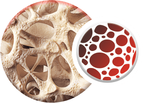 Bone Marrow Aspirate Concentrate - Specialities