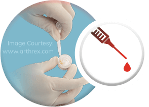 Interfyl® Human Connective Tissue Matrix - Specialities