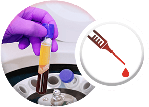 Platelet Rich Plasma - Specialities