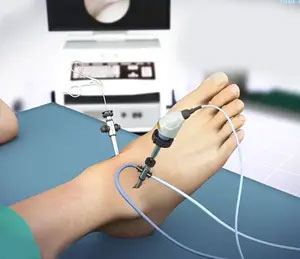 Ankle Arthroscopy