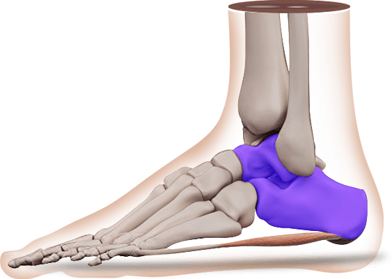 Picture of Hindfoot