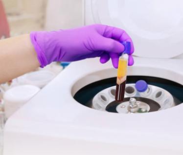 Picture of Platelet Rich Plasma