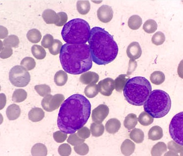 Picture of Stem Cell Therapy