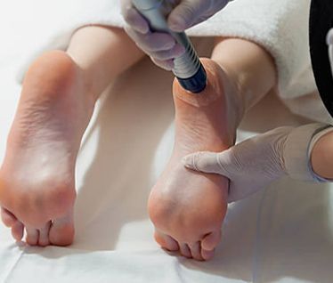 Picture of Shockwave Therapy