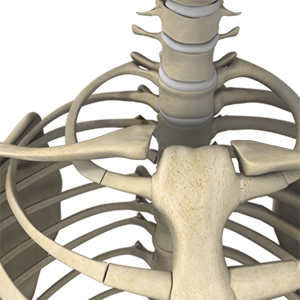 Img- Sternoclavicular Separation 