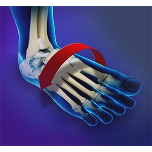 Ankle Instability Surgery sp