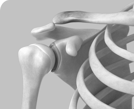 Picture of Shoulder Instability