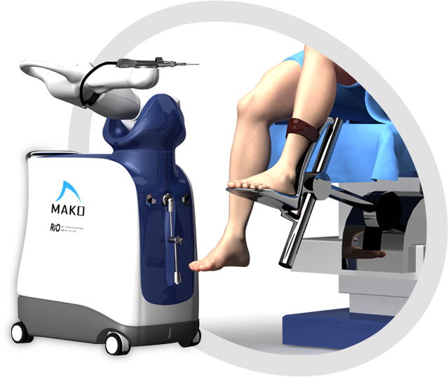 Robotic-Assisted 
Knee Replacement