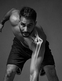 Picture of Arthroscopic Surgery