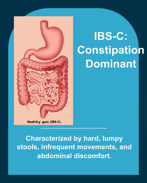 IBS-C constipation predominant irritable bowel syndrome