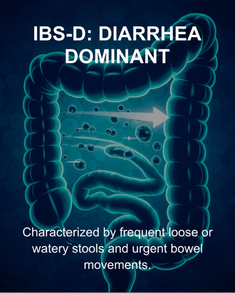 IBS-D diarrhoea predominant irritable bowel syndrome