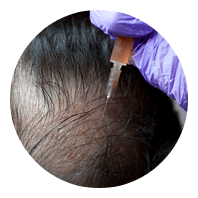 Regenerative Medicine - Service