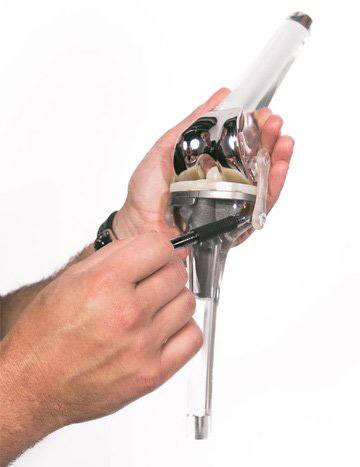 Total Knee Replacement - Gallery Pic 1