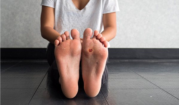Diabetic Foot Care Sb