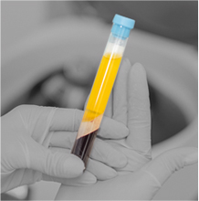 nonsurgical procedures- Shoulder