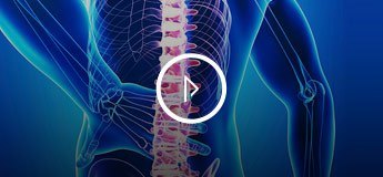 Patient Education Video