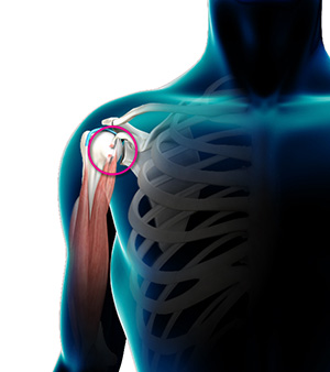 Biceps Tendon