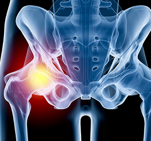 Hip Injuries logo
