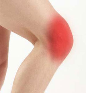 Anterior Knee Pain pic