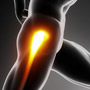 Img-Hip Labral Reconstruction