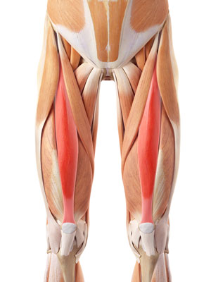 Rectus Femoris Repair pic