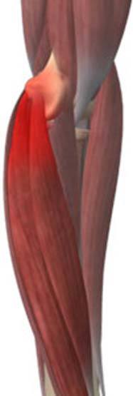 Golfer's Elbow img