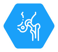 Hip Fracture
