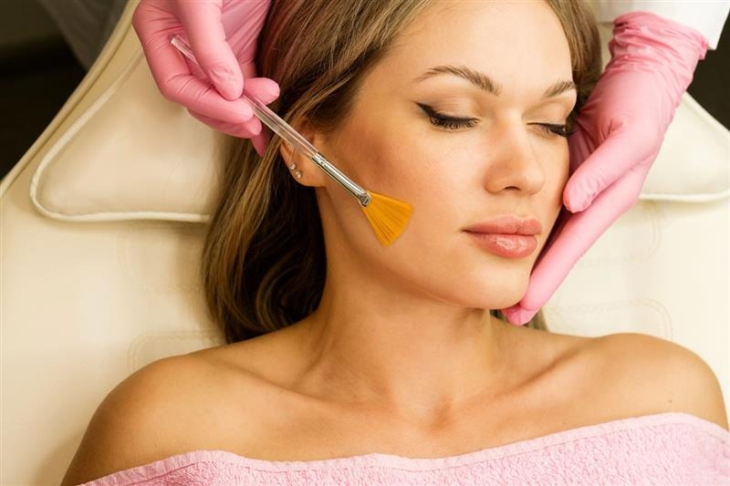 Glycolic Peel Treatment in Newport Beach for Brighter, Smoother Skin