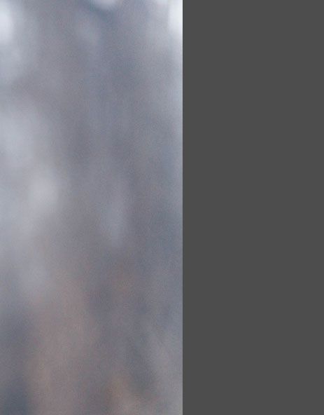 Mr. Priyank Sinha, Consultant Spinal Neurosurgeon