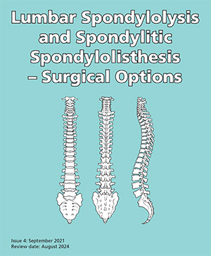 Lumbar Spondylolysis for Spondylitic Spondylolisthesis