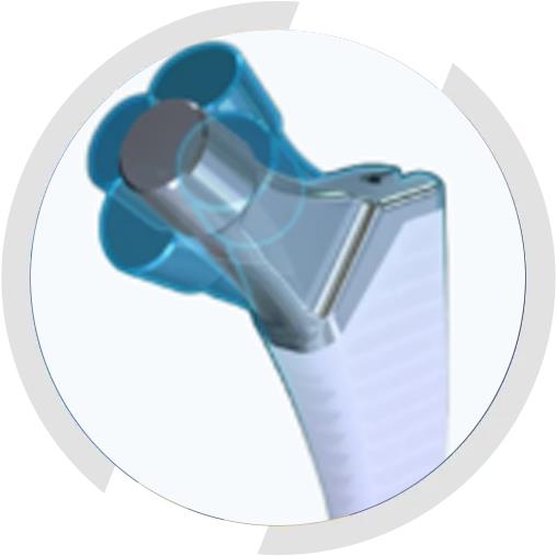 restor3d Hip Implant