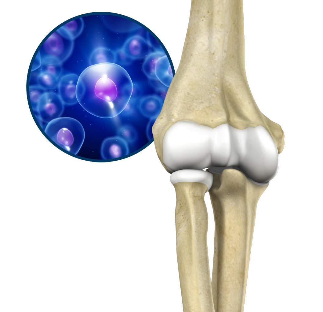 Orthobiologic Treatments for the Elbow