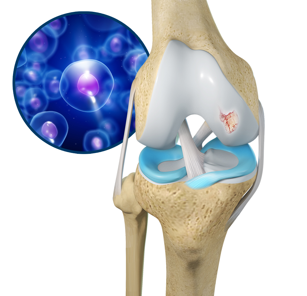 Orthobiologics for the Knee