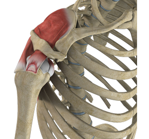 Partial Rotator Cuff Tear