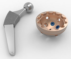 Hip Implants pic