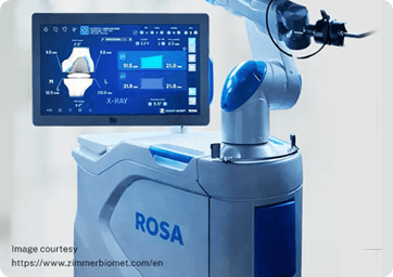 ROSA Robotic Total Knee Replacement