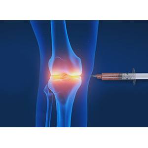 Lipogems
