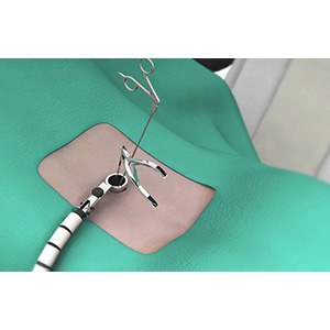 Minimally Invasive Spine Surgery
