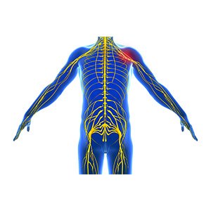 Peripheral Nerve Compression