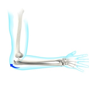 Elbow Dislocation Sp