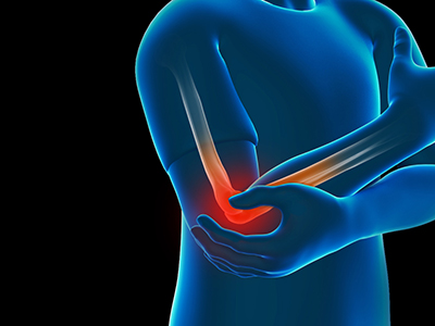 Elbow Injuries - Educational Photo