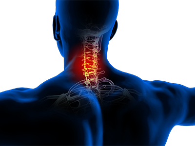 Neck Pain - Educational Photo