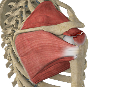 Rotator Cuff Tear - Educational Photo
