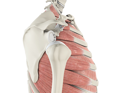 Shoulder Labrum Reconstruction - Educational Photo