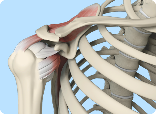 Rotator Cuff Repair