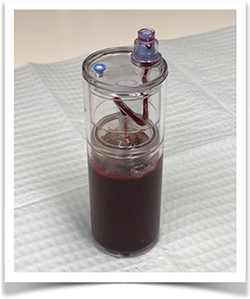 Picture of Cell-based Therapy