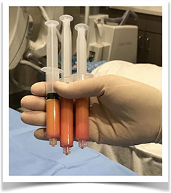 Picture of Cell-based Therapy